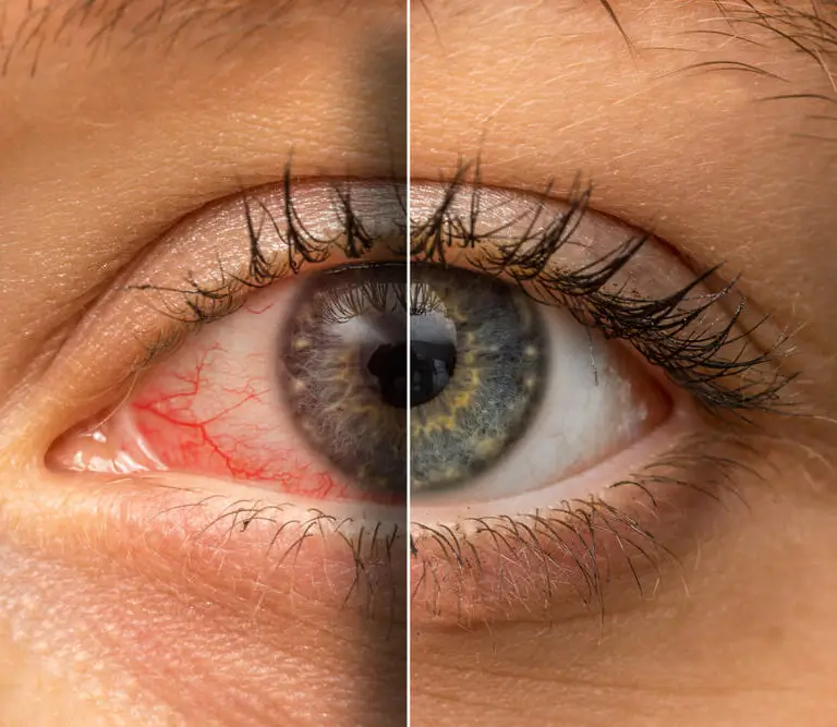 High Blood Pressure Vision