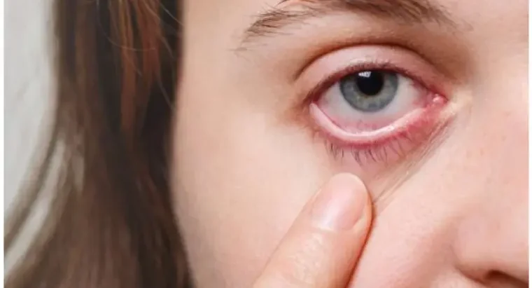 Causes of Mucus Fishing Syndrome: How to treat it