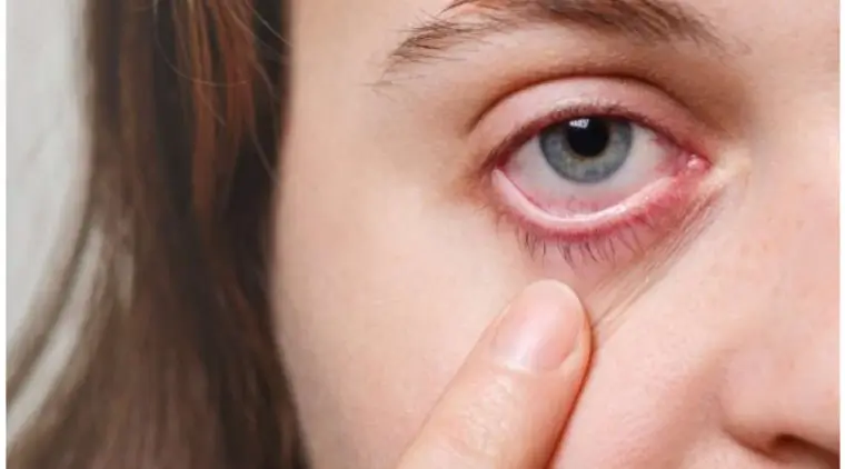 Causes of Mucus Fishing Syndrome: How to treat it