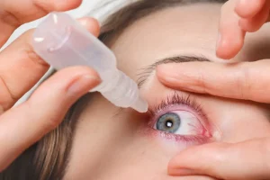 Treatment of Eyelid Inflammation