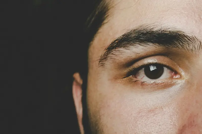 Dry eyes