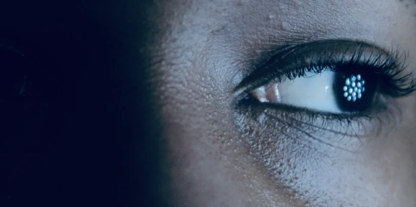 Visual Snow Syndrome